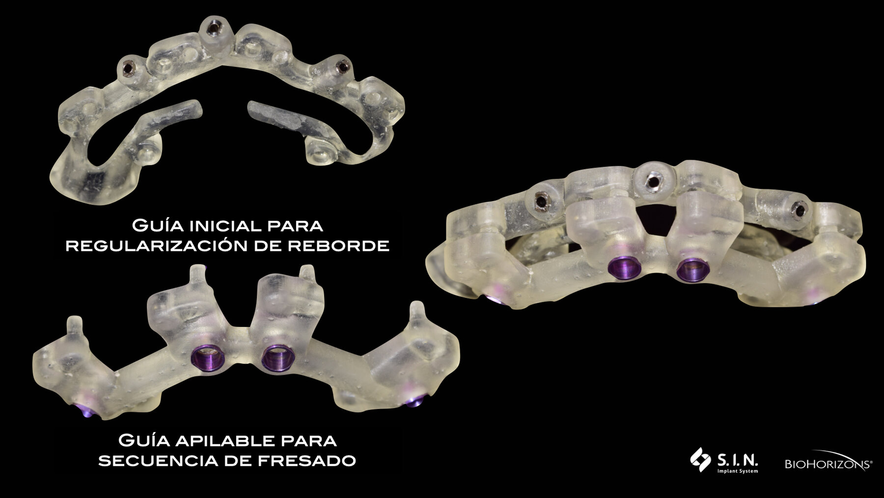 Guías para la ejecución clínica